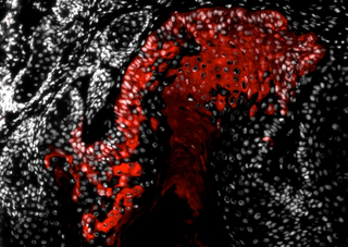 Illustration for article titled Stem cell finding will lead to a "paradigm shift" in cancer treatments